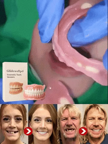 ⏳ Limited-Time Offer | Premium Full Cover Dentures
