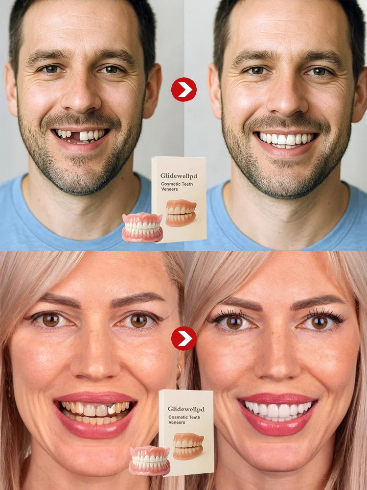 ⏳ Limited-Time Offer | Premium Full Cover Dentures