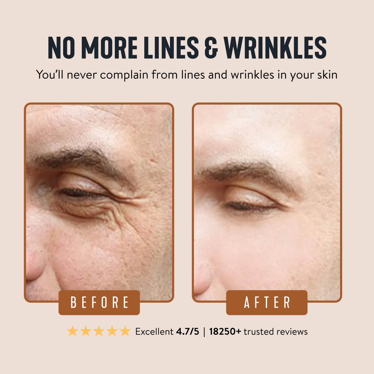 💥 Buy 1, Get 1 Free💥 Wrinkle Defense Tallow Balm