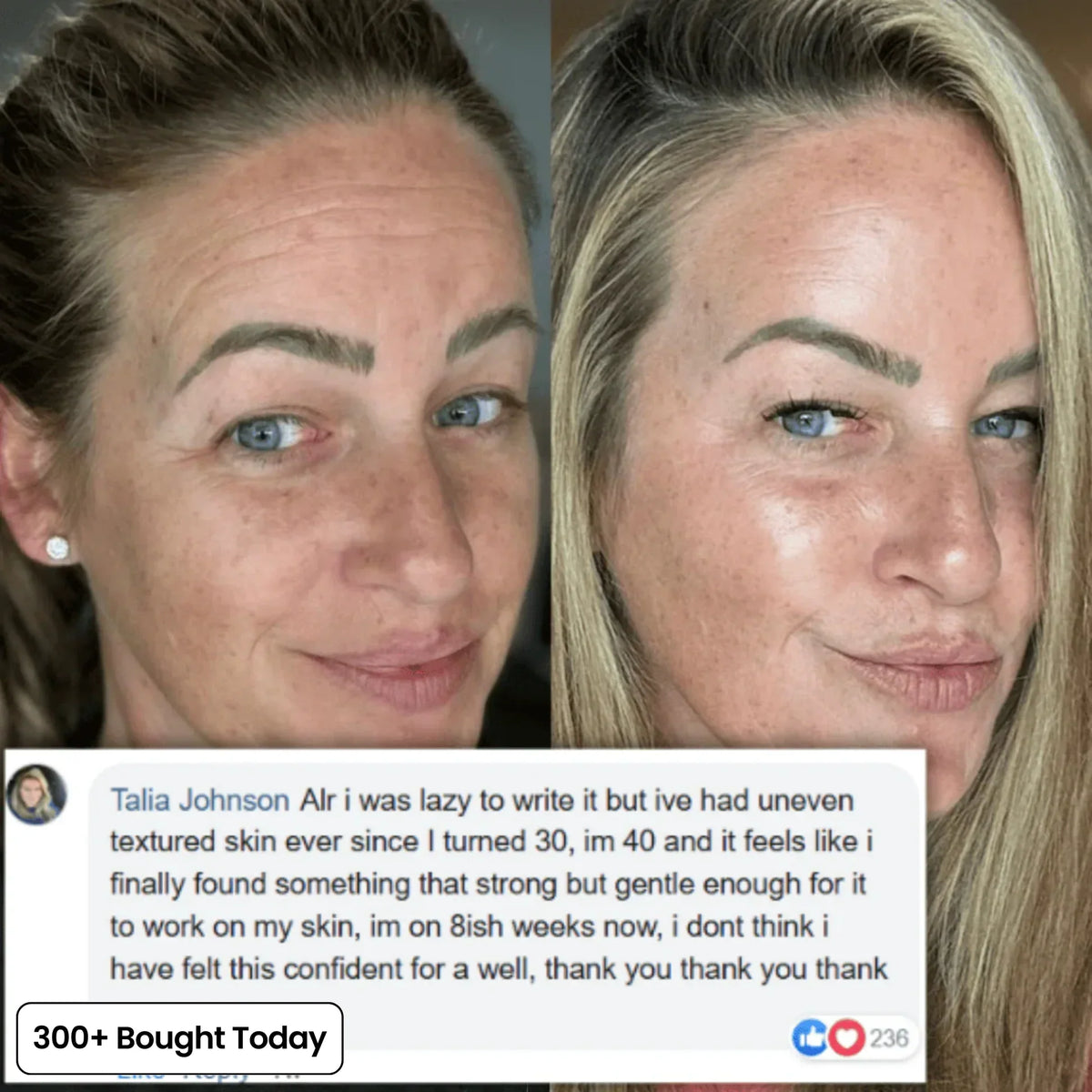 🎀Pink Collagen Volume Multi Balm🎀